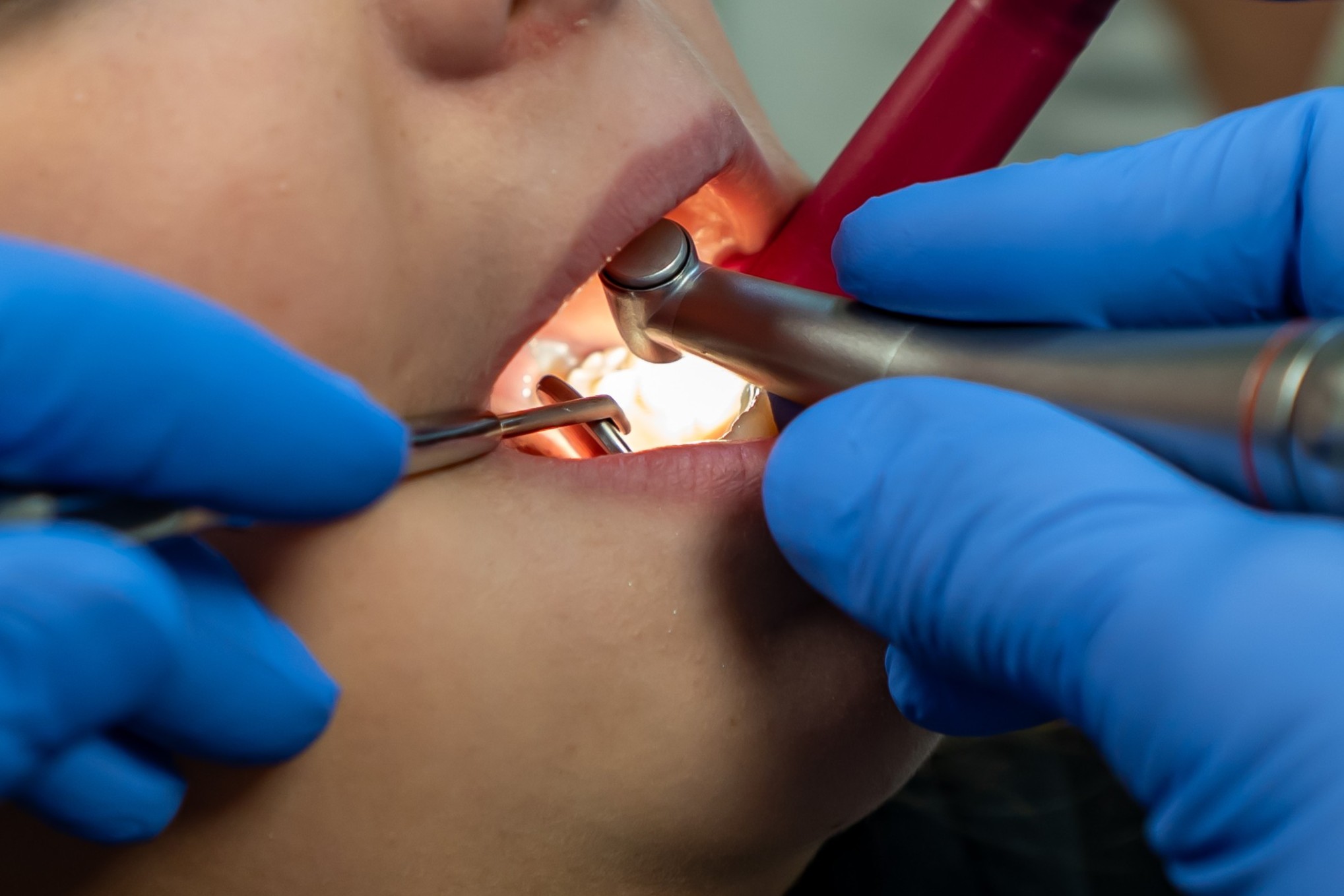 07 Schonende Behandlung DSC09975 bearb