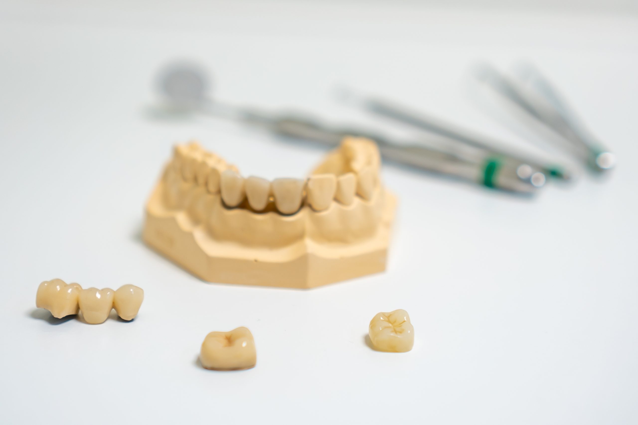 08 Kronen und Brücken DSC00235