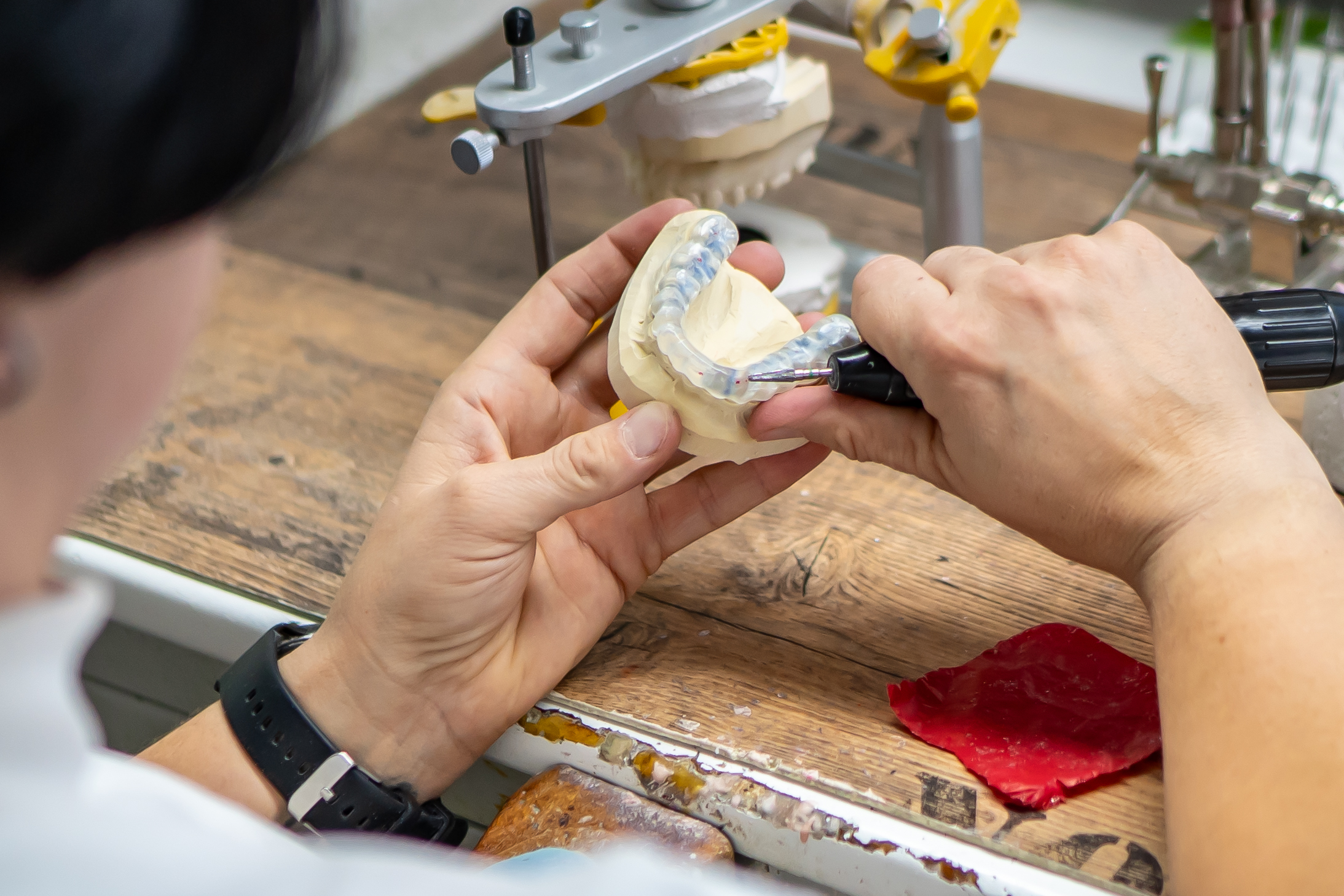 17 Schienentherapie DSC09633